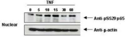 Western Blot: RelA/NFkB p65 [p Ser276] Antibody [NBP1-77807]